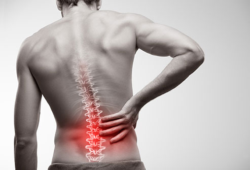 Back Pain: Causes And Symptoms