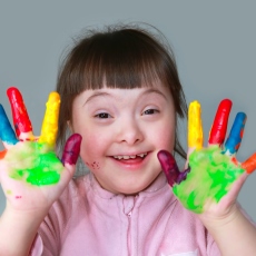 What Is A Down Syndrome?