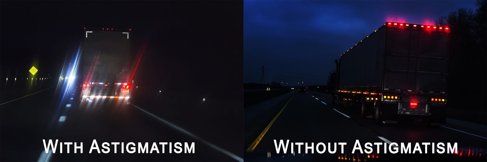 What Is Astigmatism?