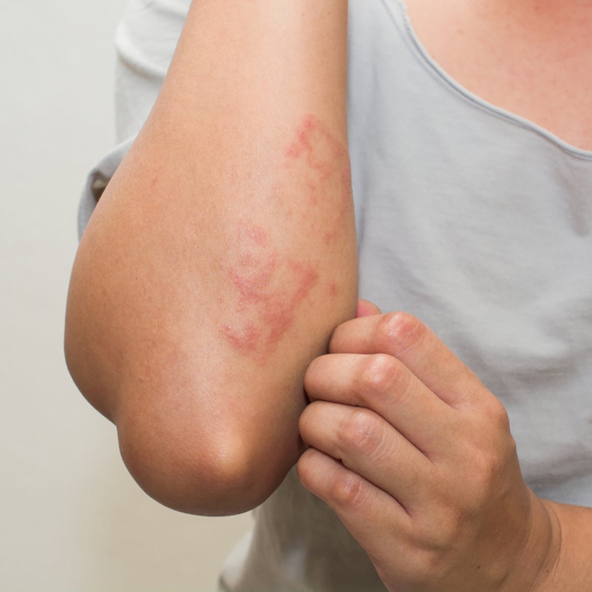 How To Relieve Itchy Skin?