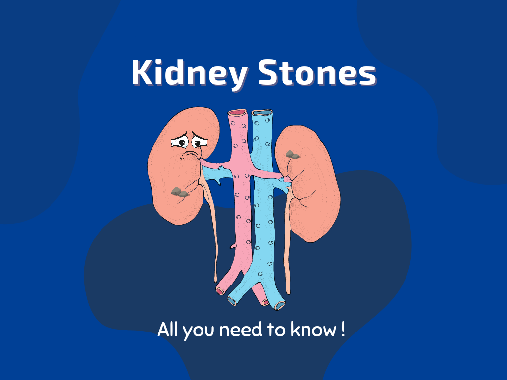 Kidney Stone- All You Need To Know