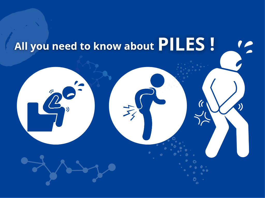 Things To Know About Piles