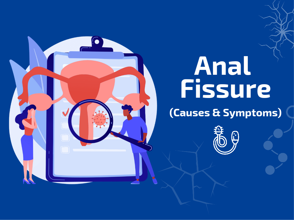 Anal Fissure Causes & Symptoms