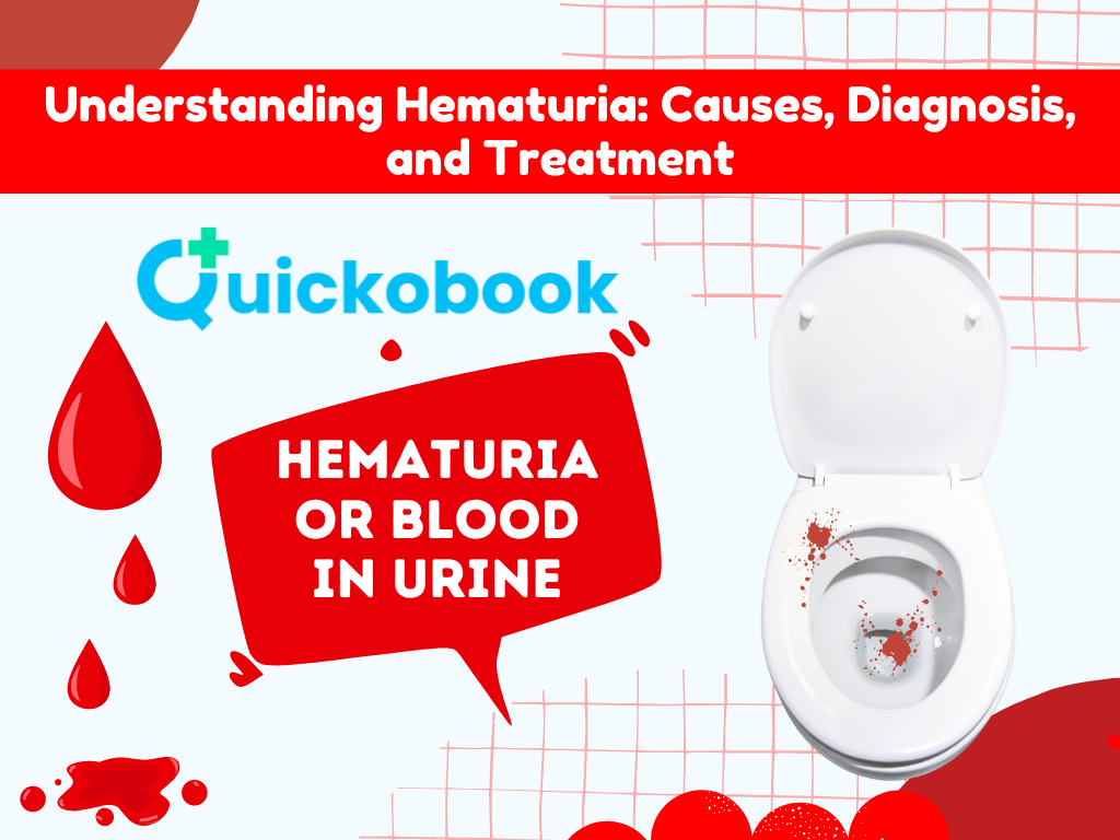 Understanding Hematuria : Treatment, Causes & Diagnostics