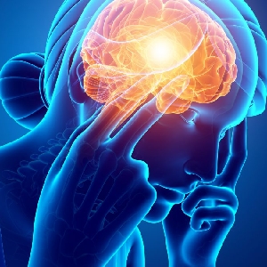 What Is Migraine